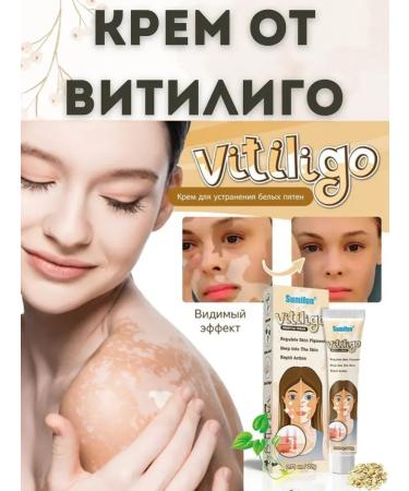 Kamielli Whitening cream from age spots for the face and body - Buy Online on GoSupps.com