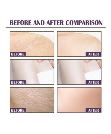 Eelhoe cleansing of the skin exfoliation of dead cells of scrub ... - Buy Online on GoSupps.com