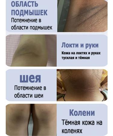 whitening cream for the intimate area of Dodoyuri - Buy Online on GoSupps.com
