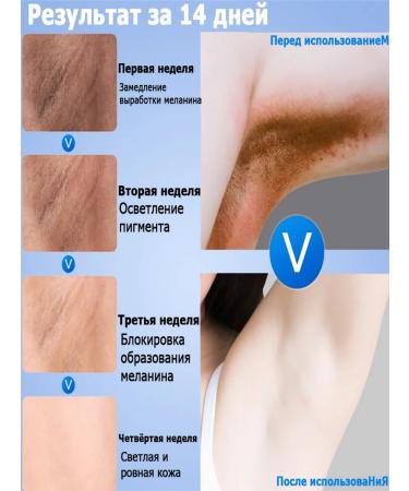 whitening cream for the intimate area of Dodoyuri - Buy Online on GoSupps.com