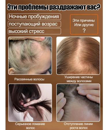 LYDIMOON Women's professional shampoo from hair loss 500ML - Buy Online on GoSupps.com