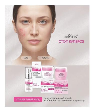Belita Night Restoring Facial Cream Stop Minovis - Buy Online on GoSupps.com
