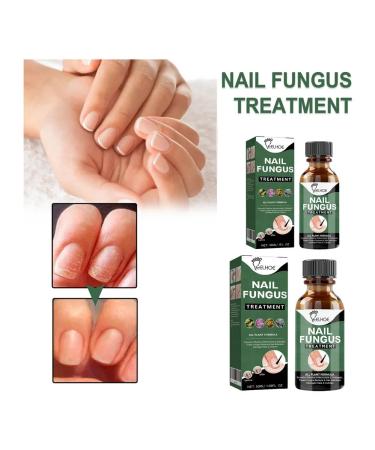 Eelhoe nail care tool 50 ml - Buy Online on GoSupps.com