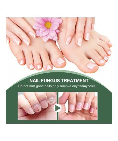 Eelhoe nail care tool 50 ml - Buy Online on GoSupps.com
