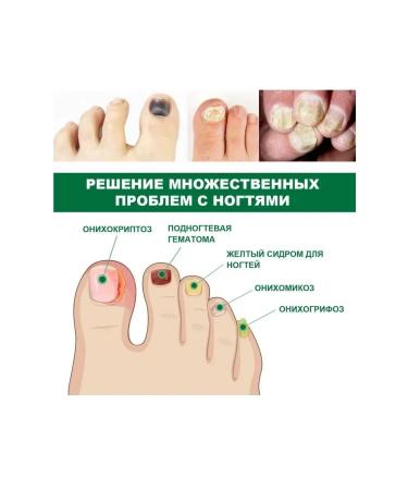 Ouhoe Ground Nog by the repair essence antibacterial fragile - Buy Online on GoSupps.com