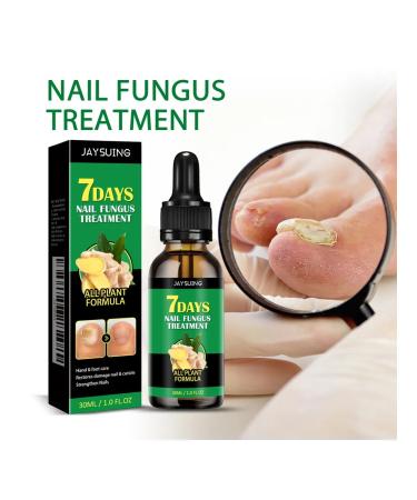 Jaysuing treatment of nail fungus tool for nail care