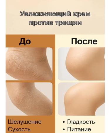 MK82 Moisturizer against cracks dry damaged skin - Buy Online on GoSupps.com