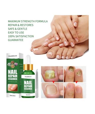 WEST & MONTH Antifungal nail tool 3 pcs - Buy Online on GoSupps.com