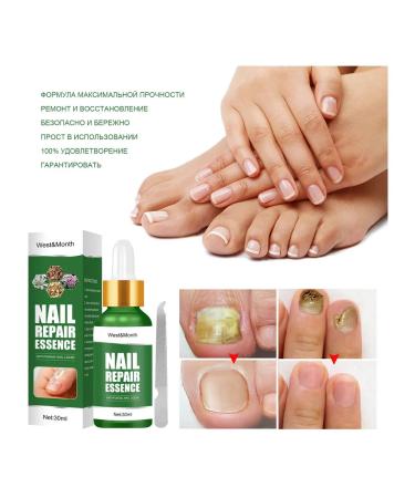 WEST & MONTH Antifungal nail tool 3 pcs - Buy Online on GoSupps.com