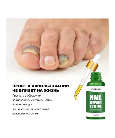 WEST & MONTH Antifungal nail tool 3 pcs - Buy Online on GoSupps.com