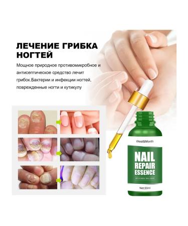 WEST & MONTH Antifungal nail tool 3 pcs - Buy Online on GoSupps.com