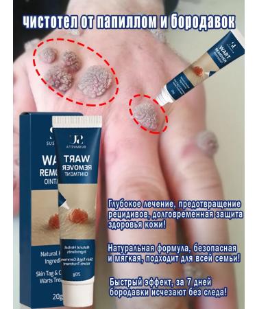 Ointment from warts papillomas and corns