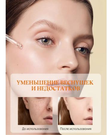 DRSKINVITA Set Essence + Eye Cream*2 - Buy Online on GoSupps.com