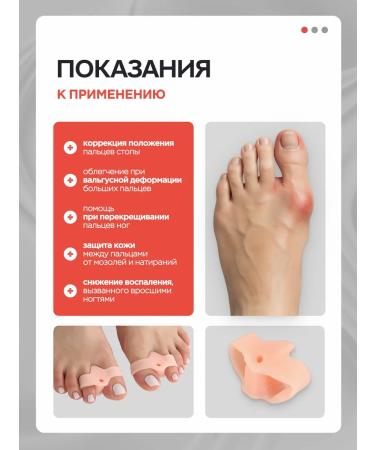 MEDKING Valgus Corporetor Diviner of the Thumb's Legs - Buy Online on GoSupps.com