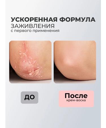 ROSILAK Cream wax for very dry skin and peeling - Buy Online on GoSupps.com