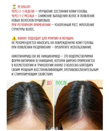 ZARAWASH Hair density with nicotinic acid from acne - Buy Online on GoSupps.com