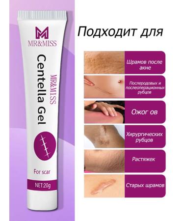 Cream from scars and traces of post -acne - Buy Online on GoSupps.com