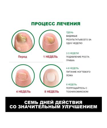 JaySuing nails with nails ginger solution suppress the growth of fungi 30 ml - Buy Online on GoSupps.com