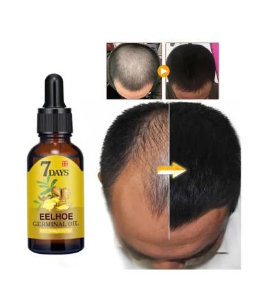 eelhoe Ginger hair growth Essence prevents 40 ml loss - Buy Online on GoSupps.com