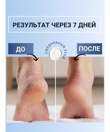 OYLI Feet cream with urea 10% of corns and cracks - Buy Online on GoSupps.com