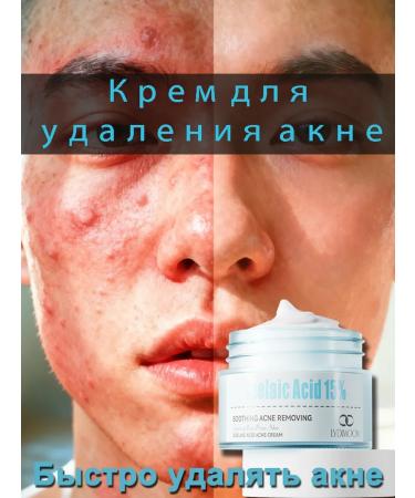 LYDIMOON Acne cream with azelainic acid 30 g