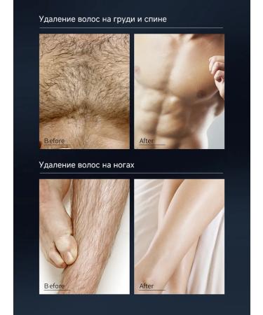DETVFO Depilation cream for men body and intimate zone 100g - Buy Online on GoSupps.com