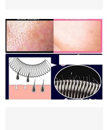 Eldos27 Female epalator remove the antennae of the gun on the face of Pinzet - Buy Online on GoSupps.com