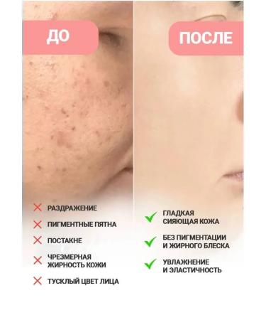 Facial serum Anua Brightening Serum with Niacinamide and Tranexamic Acid - Niacinamide 10% + TXA 4% Serum 30 ml - Buy Online on GoSupps.com