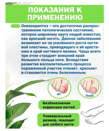 QuisLife Chabers for correction of an ingrown nail - Buy Online on GoSupps.com
