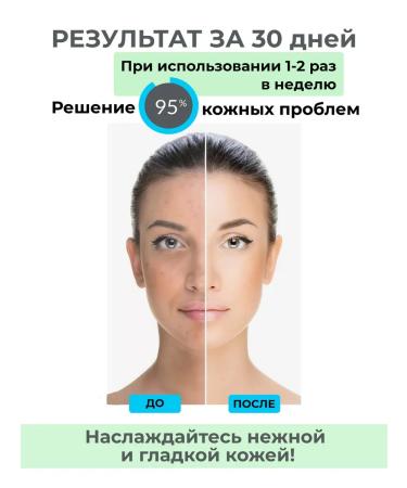 Body peeling with niacinamide and aloe - Buy Online on GoSupps.com