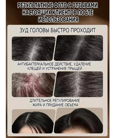 Hair growth shampoo with ginger 500 ml - Buy Online on GoSupps.com