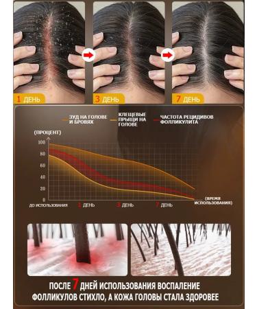Hair growth shampoo with ginger 500 ml - Buy Online on GoSupps.com
