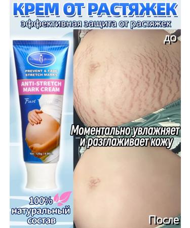DRSKINVITA Cream Oil from stretching stretch marks for pregnant women