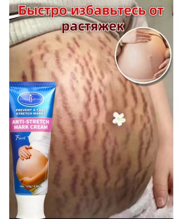 DRSKINVITA Cream Oil from stretching stretch marks for pregnant women - Buy Online on GoSupps.com