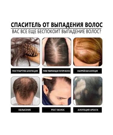 JaySuing Prevent hair loss ginger shampoo-soap - Buy Online on GoSupps.com