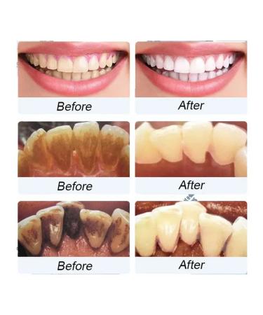 DRSKINVITA Toothpaste with mussa foam 150 g - Buy Online on GoSupps.com