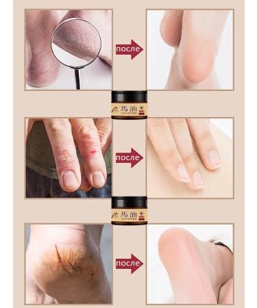 Moisturizer for legs with horse fat 35 g - Buy Online on GoSupps.com
