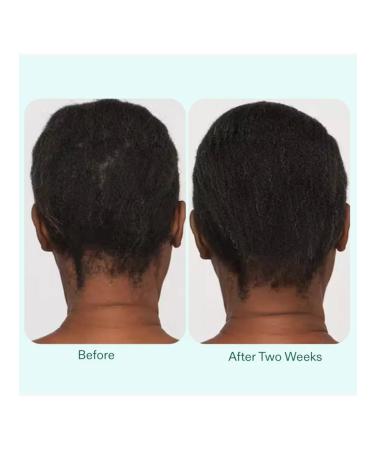 NUTRAFOL Light protective air conditioner for thin hair - Buy Online on GoSupps.com