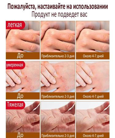 Hand and legs with a horse's oil 35 ml - Buy Online on GoSupps.com