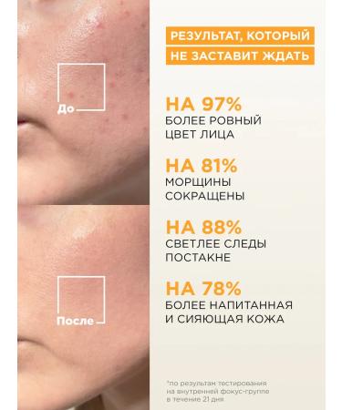 MIXIT Facial serum with vitamin C and pigmentation cream - Buy Online on GoSupps.com