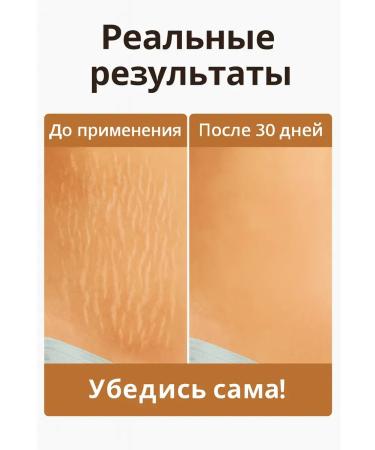 Kirunya Stretch mark removal cream - Buy Online on GoSupps.com