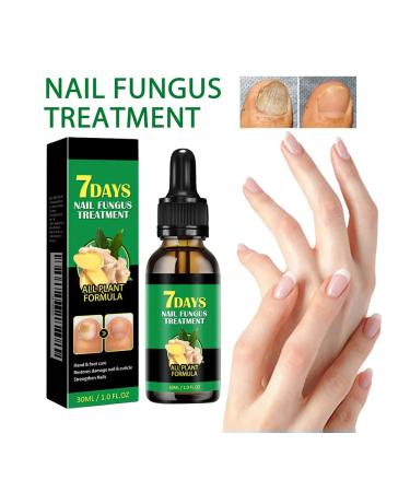 30ml ginger sulfur for nails against the fungus moisturizing