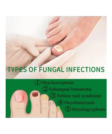 30ml ginger sulfur for nails against the fungus moisturizing - Buy Online on GoSupps.com