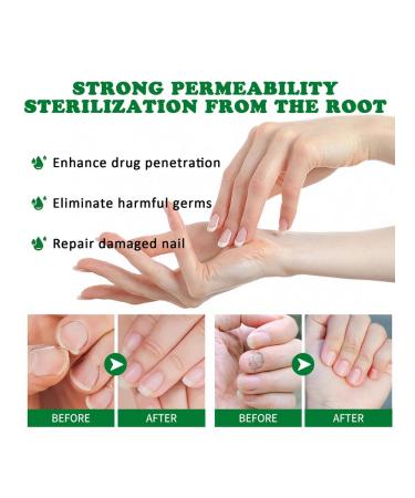 30ml ginger sulfur for nails against the fungus moisturizing - Buy Online on GoSupps.com