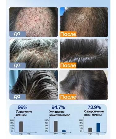 Shampoo against dandruff with selenium disulfide - Buy Online on GoSupps.com