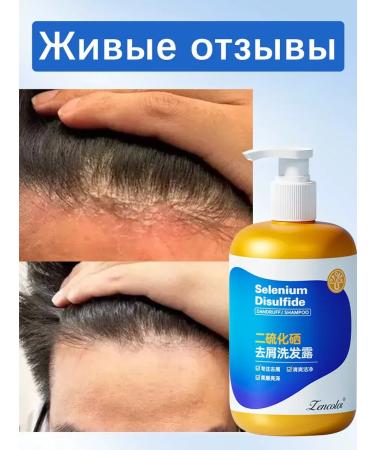 Shampoo against dandruff with selenium disulfide - Buy Online on GoSupps.com