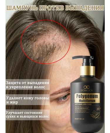 LYDIMOON Hair dropping shampoo 500 g