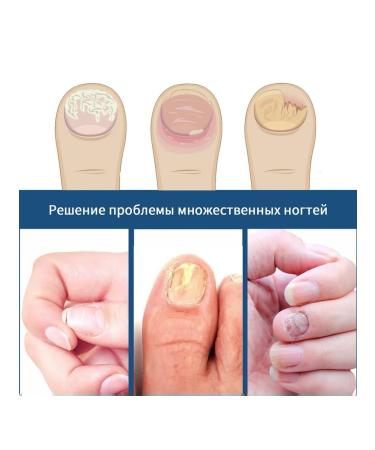 Slateers for nail care improvement - Buy Online on GoSupps.com