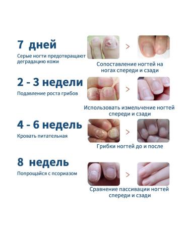 Slateers for nail care improvement - Buy Online on GoSupps.com
