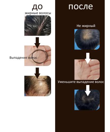 LYDIMOON Hair growth Hair ginger from falling out - Buy Online on GoSupps.com